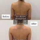[전주신부관리] 끌리네피부관리 신시가지효자점 : 완벽한 드레스 핏을 위한 '웨딩드레스라인관리' 리얼...