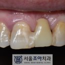 서울조아치과 이미지