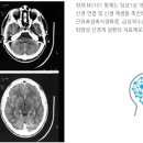 혁신신약 개발 뉴라클사이언스 이미지