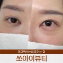 쏘아이뷰티