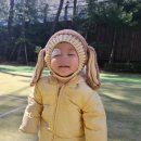 화사랑병원 | 창원화사랑병원 흉터치료 아기 눈가 찢어짐 봉합수술후기