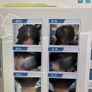 두피 탈모 아미치 0.3 수원점 이미지