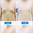 서울TOP비뇨기과 네이버블로그