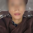 싸모님댁 | 압구정로데오역피부과 소프웨이브 고주파리프팅 솔직 후기