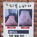진피부.바디샵