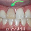 서울미소샘치과의원 이미지