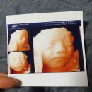 삼평동672-1 | &#39;제대혈보관&#39; 해야하는이유 셀트리 제대혈은행 면역세포 👶