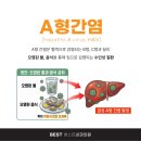 강한내과의원 | [성남모란역내과] 봄철 조개 먹고 고열에 설사까지? 전염성 강한 A형 간염 주의보