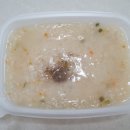 [KMI 한국의학연구소 수원] 생애 첫 정밀종합검강검진 후기