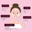 알레베
