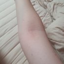 아나파신경과의원 | 잔여백신 성공 그리고 접종 후기