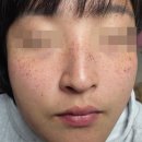 수비뇨기과의원 | 인천피부과 기미잡티제거 후기 한상희비뇨기과의원 평일 웨이팅 및 가격