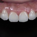 자연드림치과기공소 이미지