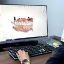 청구치과기공소 이미지