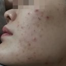 달래약국 | 피부재생크림 추천 약국템 의사크림 전부 써보고 정착함