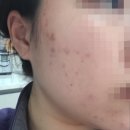 평화내과의원 | 💊진주 서명기내과 다이어트약 후기(3편) | 14일차 -4.3kg 결과 + 부작용 솔직 후기