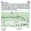 제이EMB | Resident 산부인과 밑줄긋기
