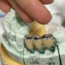 행복치과기공소 이미지