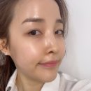 리컴뷰티 네이버블로그