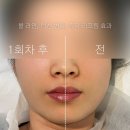 유제이 | 김해 내외동 두피관리 잘하는 곳 | 유제이뷰티 프리미엄 헤드스파 후기