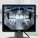 연세미페이스치과의원 | 드디어 치아 걱정 덜었다! 연세 굿 플란트 치과 다녀온 썰 푼다