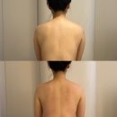 발견 | 홍대웨딩관리 여신의발견 상체슬리밍관리 후기