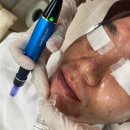 라움오토케어 | 배곧피부관리랑 남자여드름MTS관리까지 라움뷰티에서 받고 온 후기 올려봐요