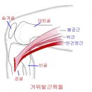 거위발 근육들과 거위발 건염 이미지