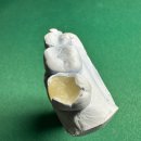 설 치과기공소 이미지