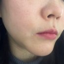 인생당한의원 | 부산 해운대한의원 한방 다이어트 한약 찐후기: 출장 길에 만난 인생 터닝포인트