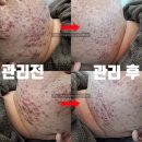 32도피부관리