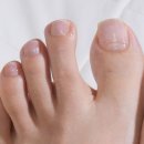 여름 샌들 신기 전 필수템! 손톱세로줄·약해진 발톱관리 라셀턴 발톱영양제 후기
