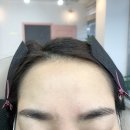 대전왁싱 대전헤어라인왁싱 용문동왁싱 럽앤제이 , 헤어라인왁싱후기 (예쁜이마라인만들기)