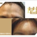 밥성형외과의원 이미지