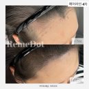헤어팡팡&가발 이미지