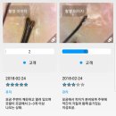 수피아헤드스파&헤나킹 | [순천두피관리] 조례호수공원 힐링코스 수피아 헤드스파