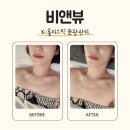 계양문화로 | 인천 계양구 피부관리 후기｜비앤뷰 K-홀리스틱 윤광관리