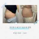11545-10-28-30 | 임신후기 배크기 몸무게 변화 임신 28주 29주 30주 31주 32주 33주 34주