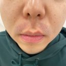 더블유피부과의원 이미지
