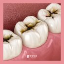 허정치과의원 이미지