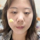 더옐로soap | 블랙헤드 없애는법 녹이기 레몬 딥클렌징밤
