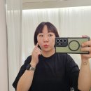 치맥킹신월성점 | 대구 피부관리의 에스테무아에서 잡티제거 리얼후기