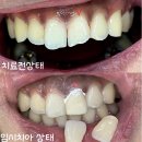 e-편한치과기공소 네이버블로그