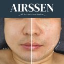 바늘 없이 이 정도? 에어쎈 니들프리 인젝터 침투력 테스트 공개!