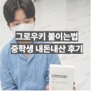 그로우키 붙이는법 중학생 내돈내산 후기 여기 붙였을 때 효과 좋았어요