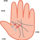 신경과민, 정신피로, 스트레스가 심한 상태를 암시하는 손금 이미지