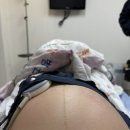 멍방구 | 👶🏻 진짜 엄마가 되었다 :: 제왕절개 수술 후기