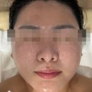 리베 | 평촌 커스텀미 리베룩 후기 — 1회 만에 속광이 살아났어요