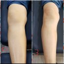 [교육] 퇴행성 무릎관절 치료 전문가 양성 과정 (7월 2일, 영광문화센타) 이미지