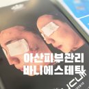 정은희스킨케어 | 아산피부관리 잘하는 곳 찾는다면 바니에스테틱 찐후기